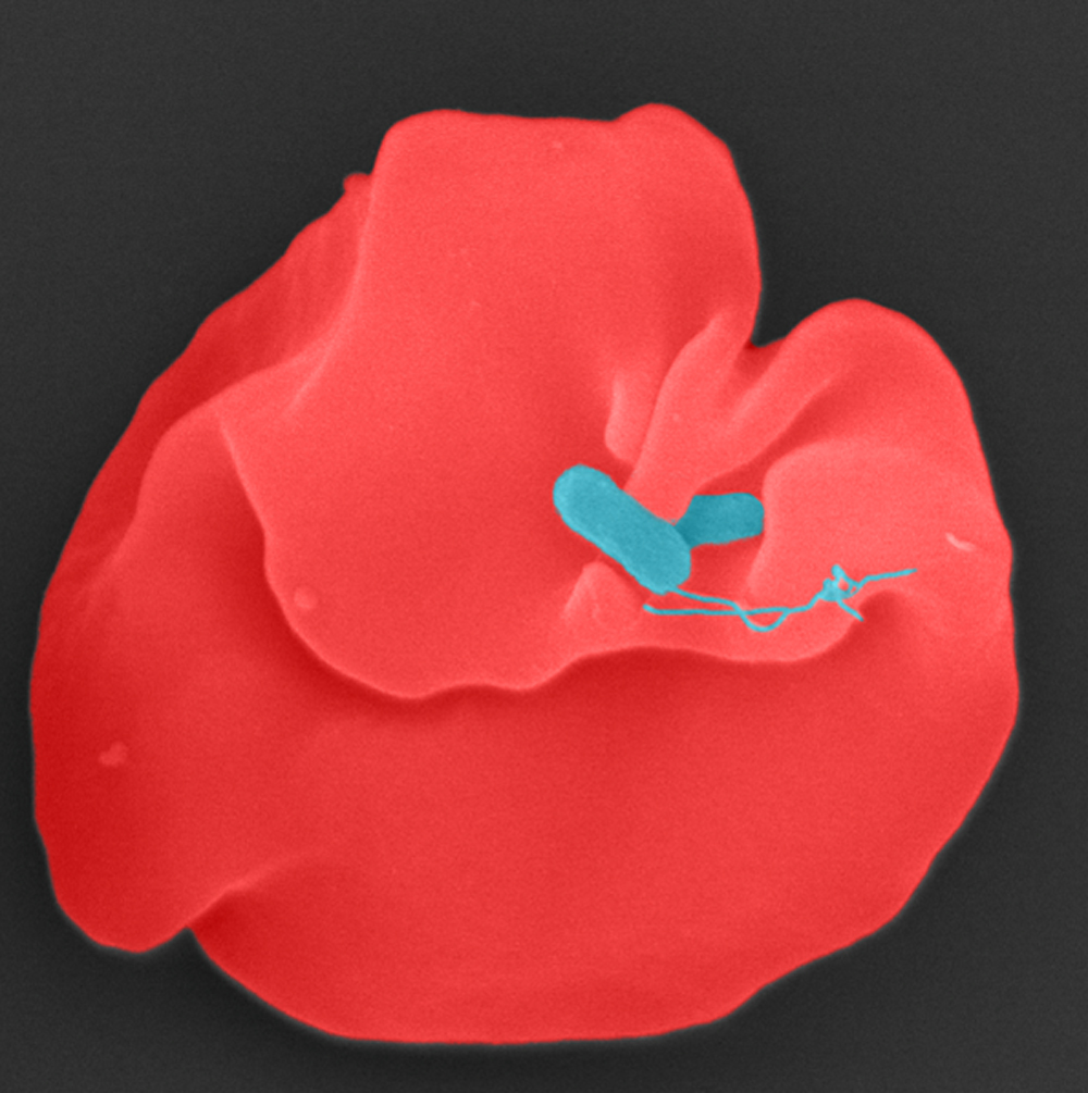 12 PM OroyaFieber Kempf